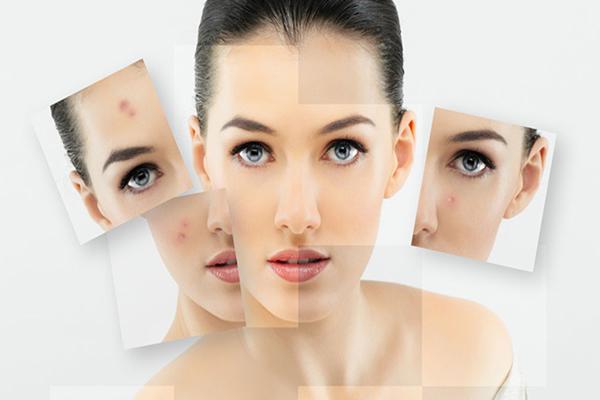 痘医生专业祛痘总结了13个长痘痘的原因，你是否中招了？