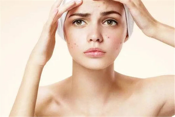  痘医生细谈初春拯救换季敏感肌