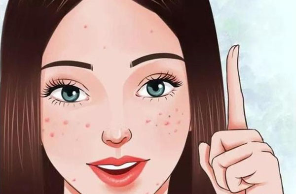 生活中如何避免痘痘？