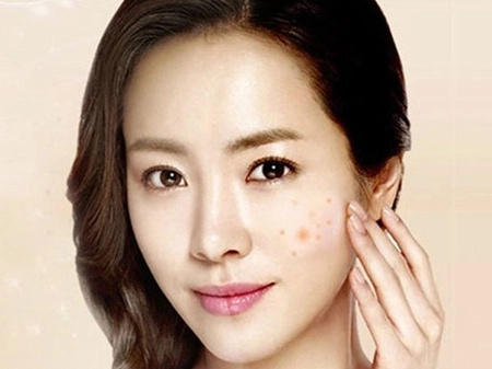 祛痘必须知道的小妙招