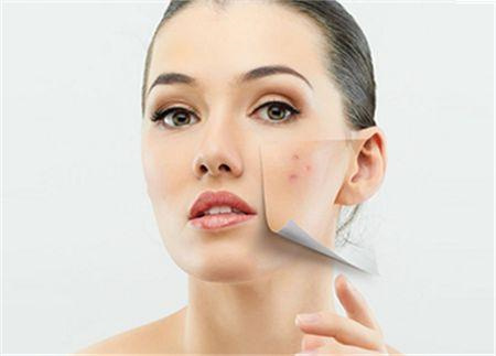 ​​痘痘的类型，以及引起痘痘的原因有哪些？