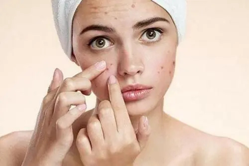 痘医生专业祛痘-勿入祛痘四大误区