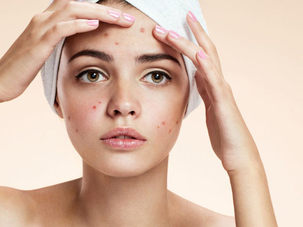 挤完痘痘出血，该怎么处理？