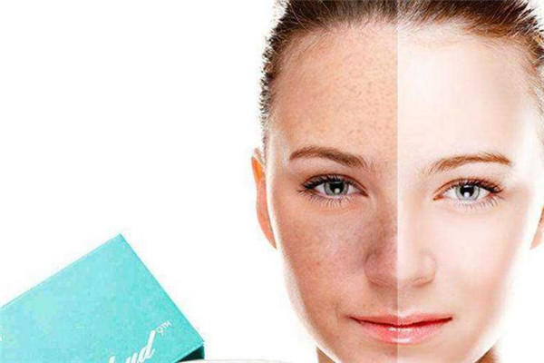 痘医生科学祛斑方案 