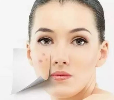 痘医生祛痘秘籍丨最快、最有效、最细节！