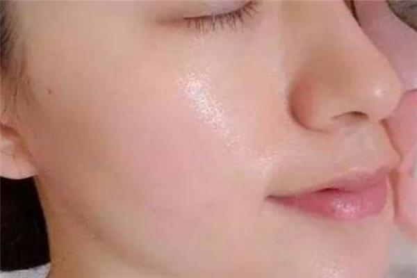 远离祛痘智商税，选好痘医生祛痘产品就能轻松祛痘！ 