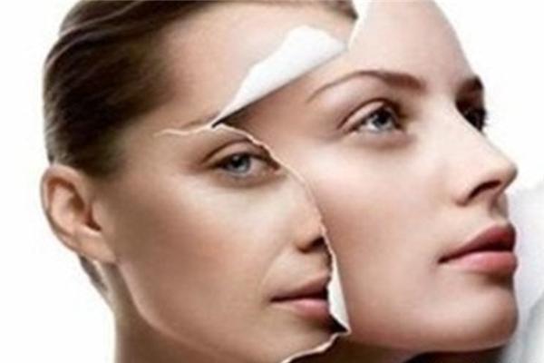 好的祛斑方法是什么？让你早日下“斑”！