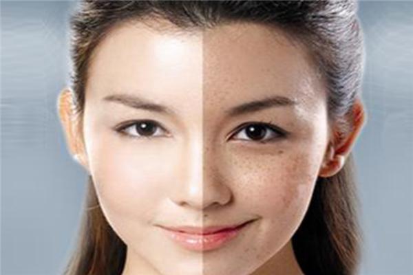 痘医生高质量祛痘指南！