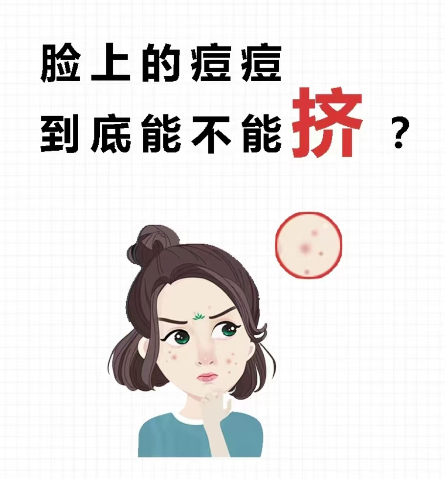 脸上的痘痘到底能不能挤？正确挤痘痘方式！